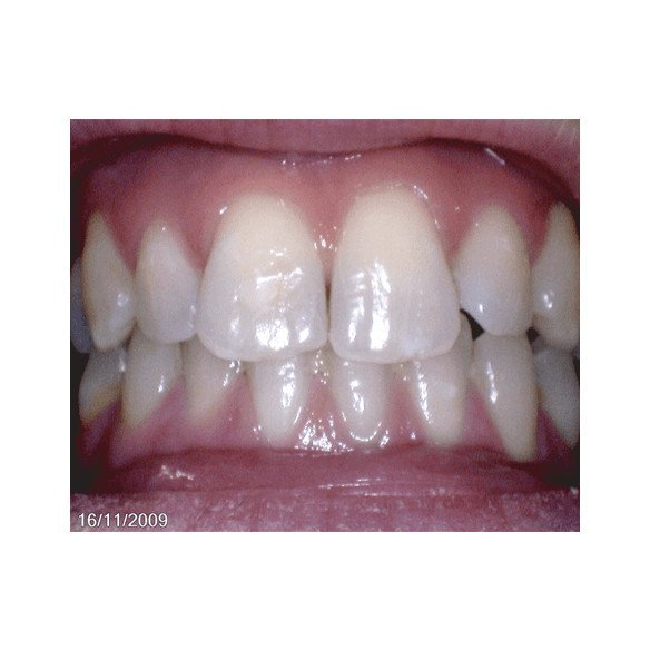 OwandyCam HD caméra intra-orale numérique USB Owandy