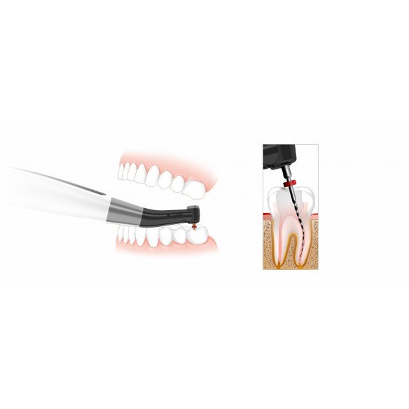 Moteur d'endodontie EndoMatic Woodpecker sans fil