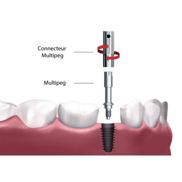 MULTIPEG réutilisable pour OSSEO NSK
