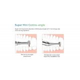 Moteur d'endodontie Endo Smart Pro Woodpecker