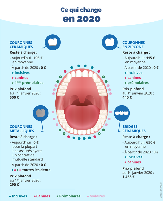 Reste à charge 0 : remboursement des soins dentaires